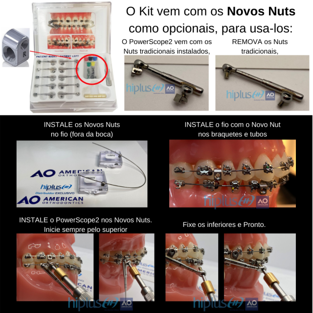 Como usar o novo closed nut